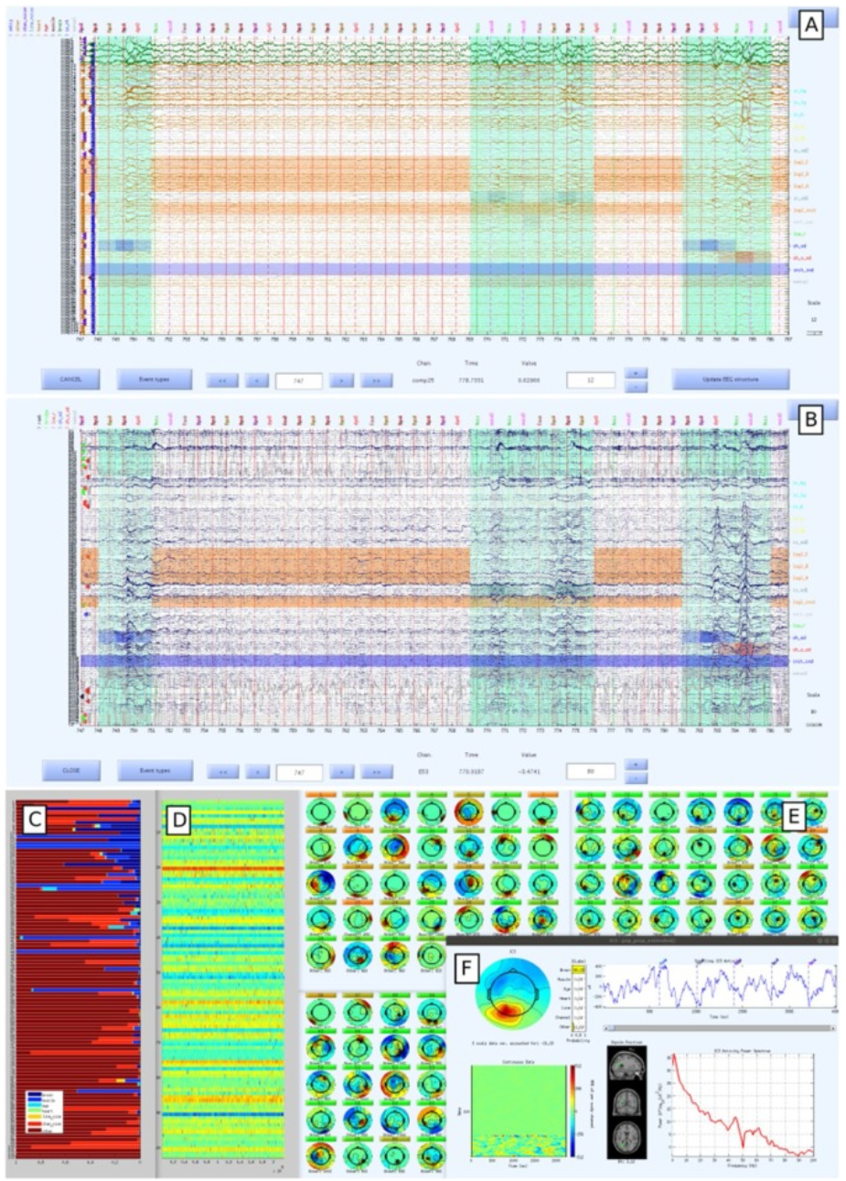 EEG-IP-L dashboard