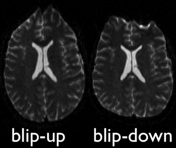 Blip up and blip down pairs