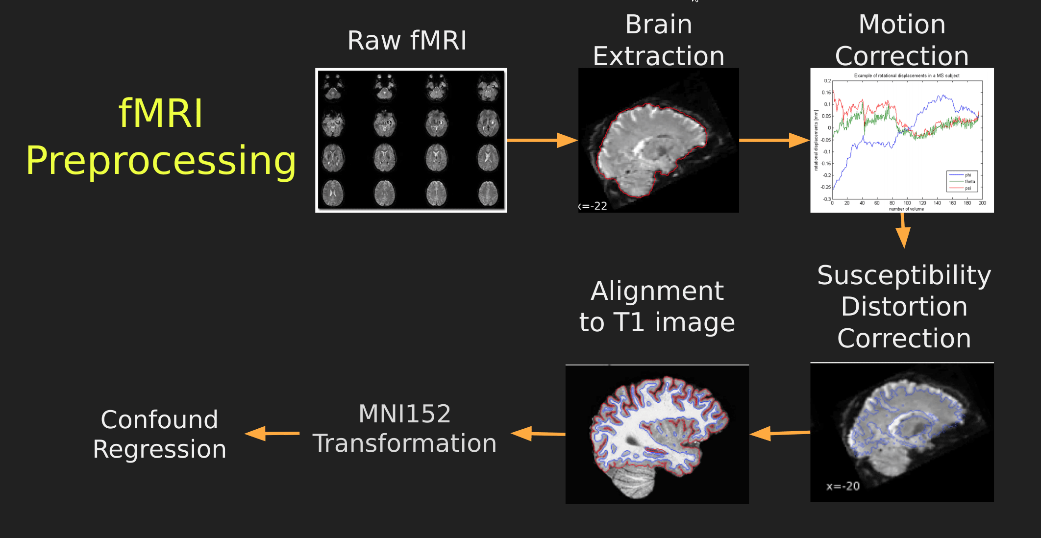 fMRI Preprocessing Steps