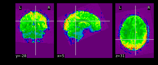 Visual of fMRI EPI Data