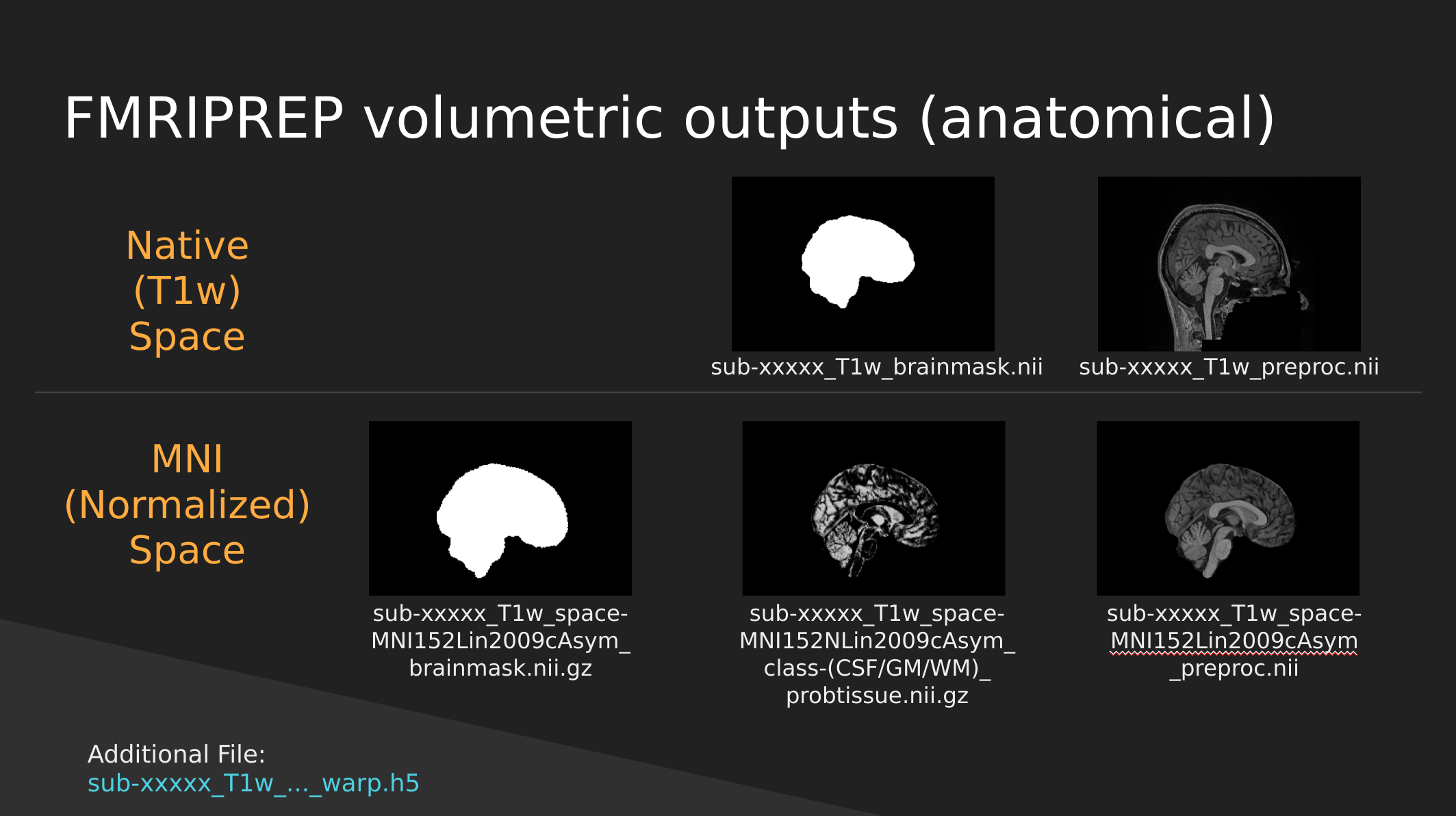 fMRIPrep Anatomical Outputs