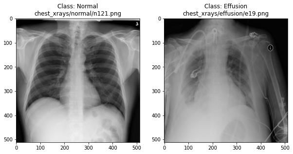 Example X-rays