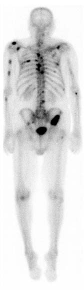 Nuclear Medicine Image.