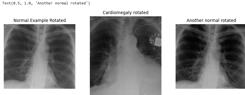 augmented chest x-ray different sizes