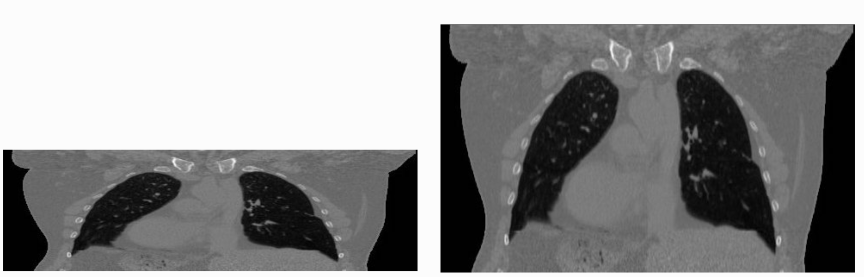 Isotropic vs non-isotropic images.