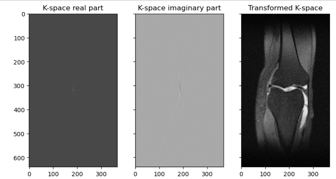 Graph of k space and processed images.