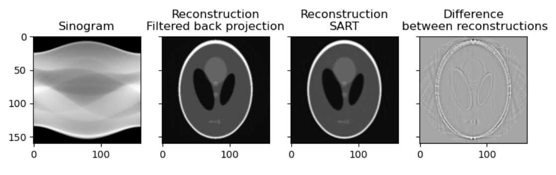 Graph of sinogram and processed images.