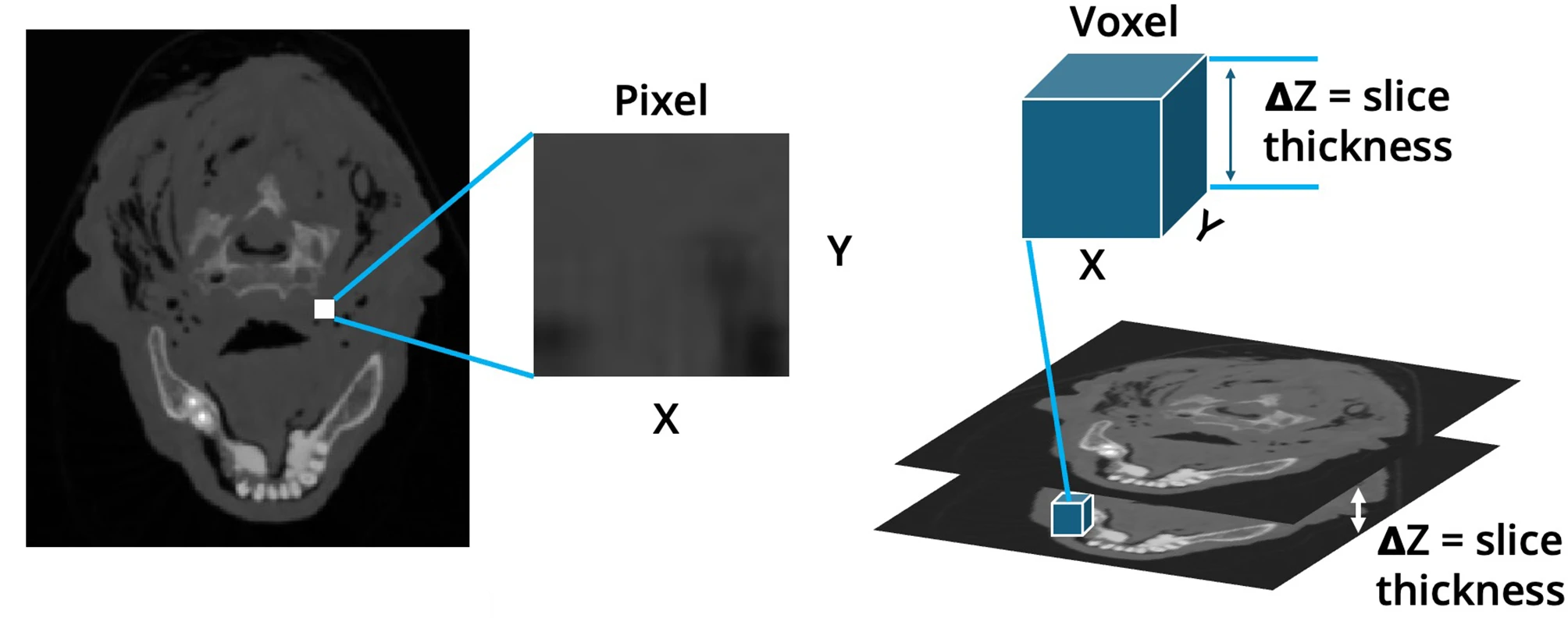 MRI slices