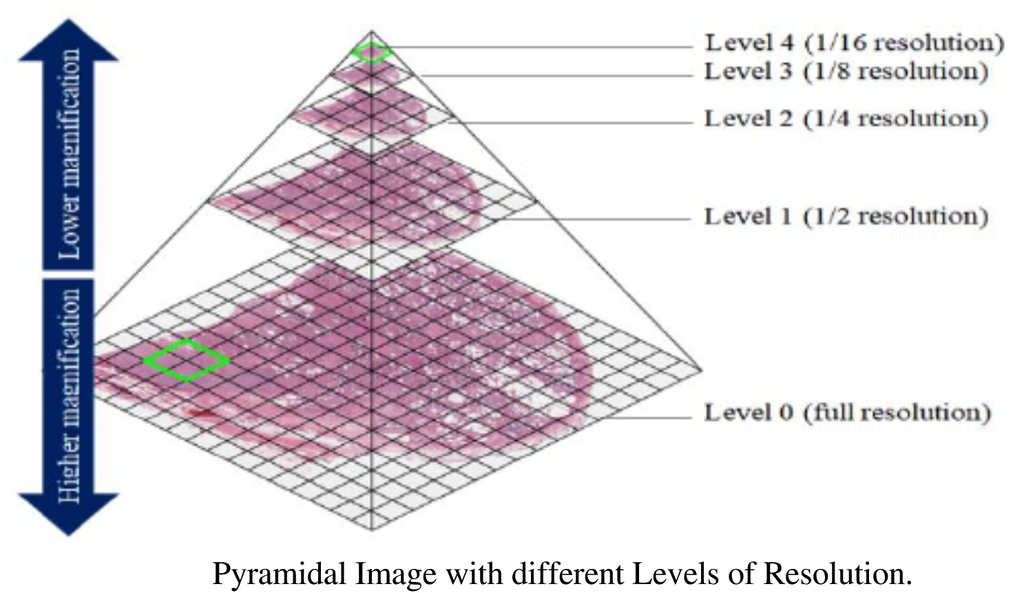  Pyramidal histopathology