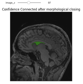 Confidence connected after morphological closing.