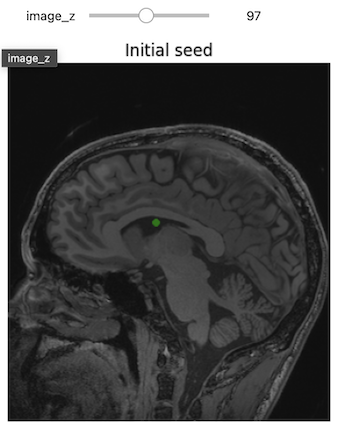 Initial seed.