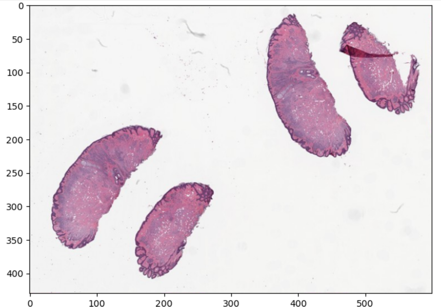  Thumbnail histopathology