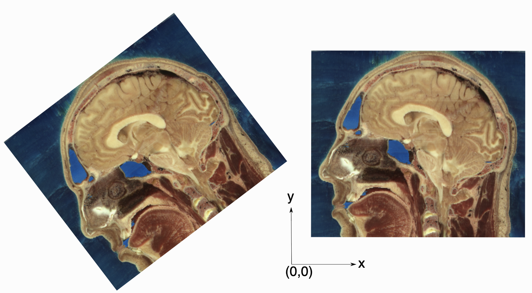 Spatial relationship in images.