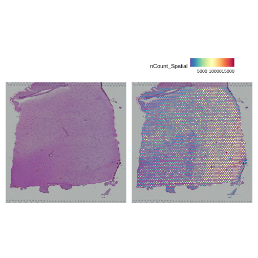 Figure showing UMI counts in each spot with varying intensity across the tissue